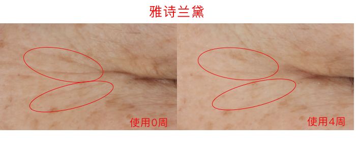 眼霜推荐lamer浓缩眼霜,lamer浓缩眼霜黑眼圈评测