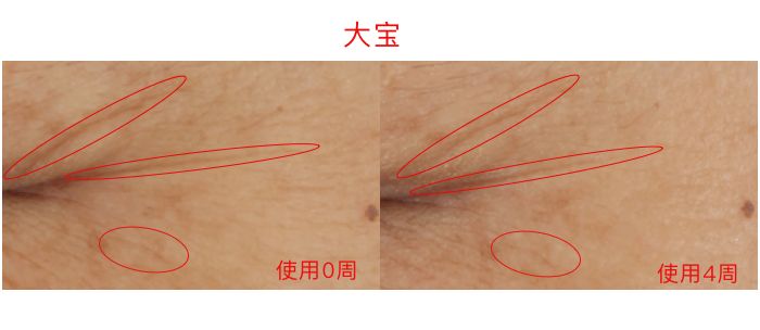 眼霜推荐lamer浓缩眼霜,lamer浓缩眼霜黑眼圈评测