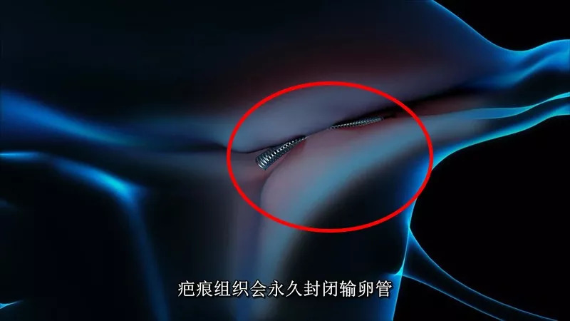 对，这就是医疗*局骗**（再不说还有人上当）