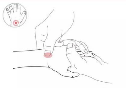 宝宝出疹一直高烧怎么办,宝宝出急疹都是发高烧吗