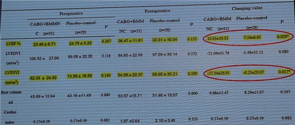 「CSCQICC2018」胡盛寿：心力衰竭的外科治疗