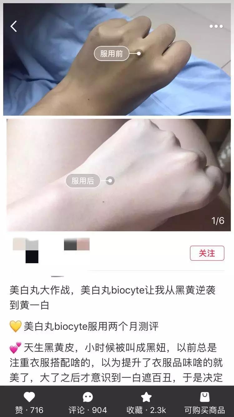 日本美白丸的功效和副作用,美白丸的副作用和危害