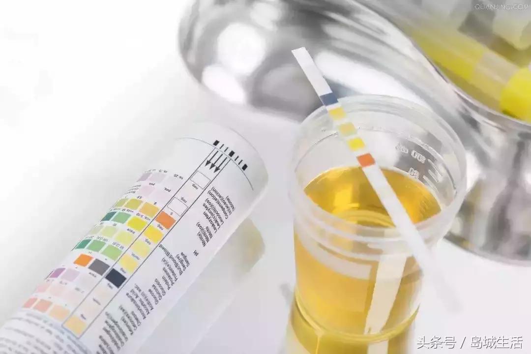 痛风久治不愈怎么办,痛风治疗这四件事真的很重要