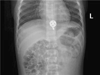 一些让人毛骨悚然拍到的照片,六个令人毛骨悚然的影像