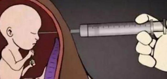 妻子多年不孕，医生竟从妻子身体里取去怪物，大开眼界