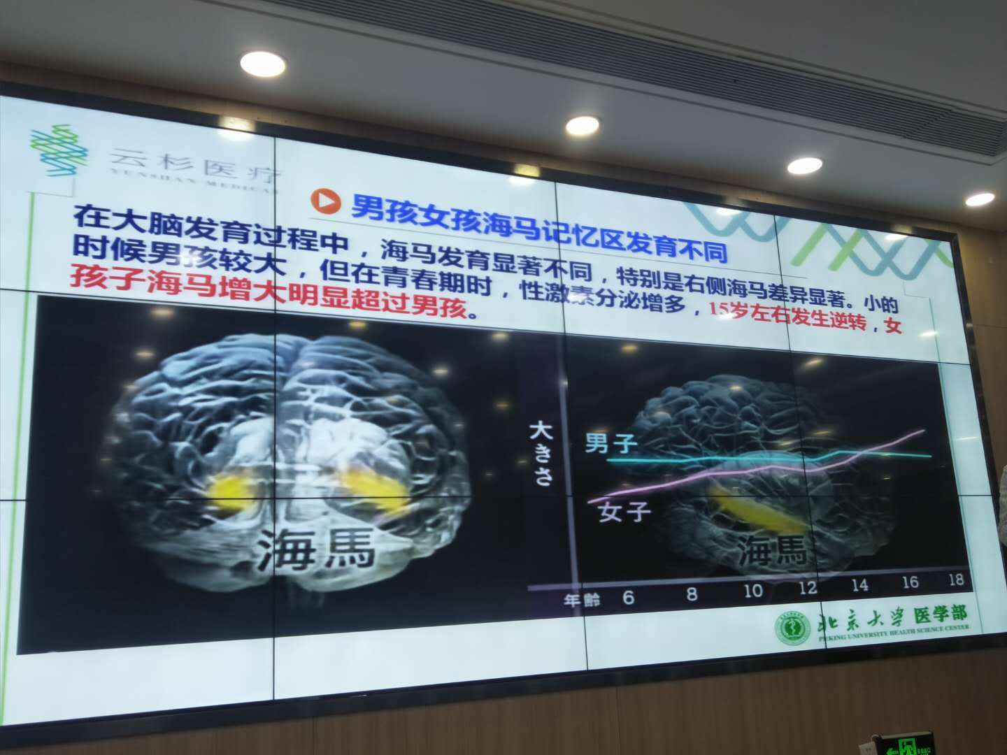 洪兰教授男女大脑思维差异完整版,洪兰教授男女大脑思维差异