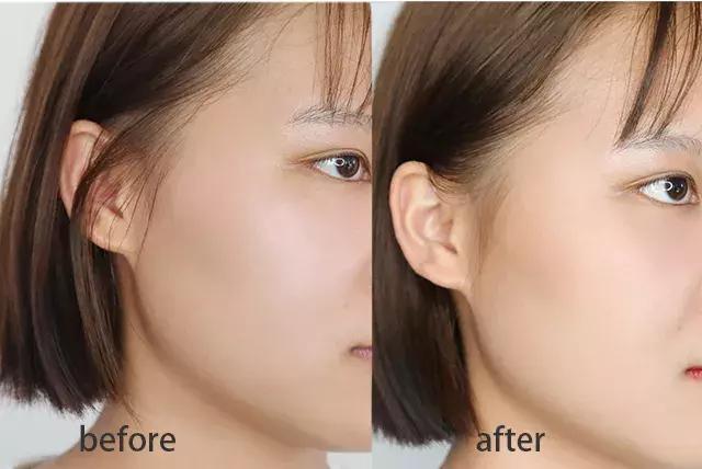 堪比整容的祛纹技巧,心机显瘦修容方法