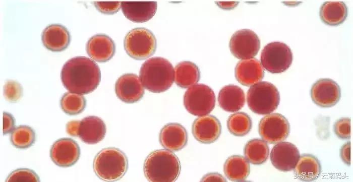 全世界排名前十的虾青素有哪些,厉害了我的国国货黑科技