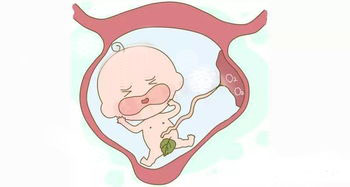 早产宝宝容易出现的常见问题,早产宝宝容易胖吗