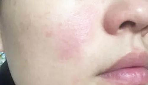 劣质化妆品对身体有什么伤害,劣质化妆品的危害视频