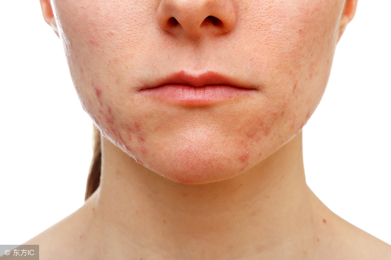 混油皮化妆品,混油皮化妆品推荐整套