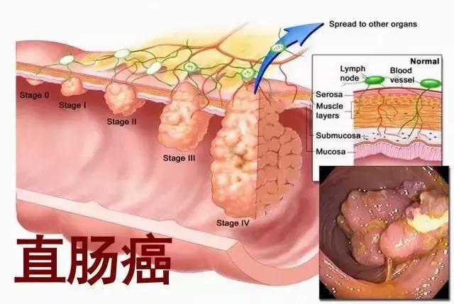 “上海第一美女”自杀,这一点却被忽略了