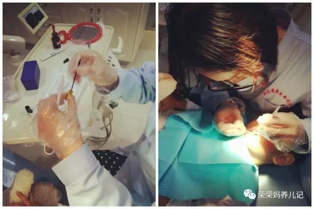 乳牙蛀牙可以不管它吗,孩子乳牙没换就蛀牙了需要补吗