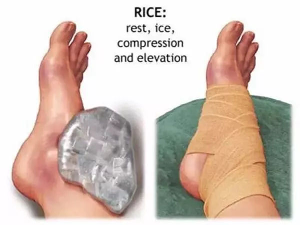 运动受伤后该怎么处理,运动受伤后如何处置