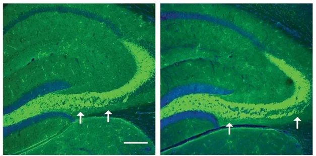 《科学》子刊：阿尔茨海默药物研发阴云再起！科学家发现BACE1*制剂抑**可能存在严重认知损失副作用｜科学大发现