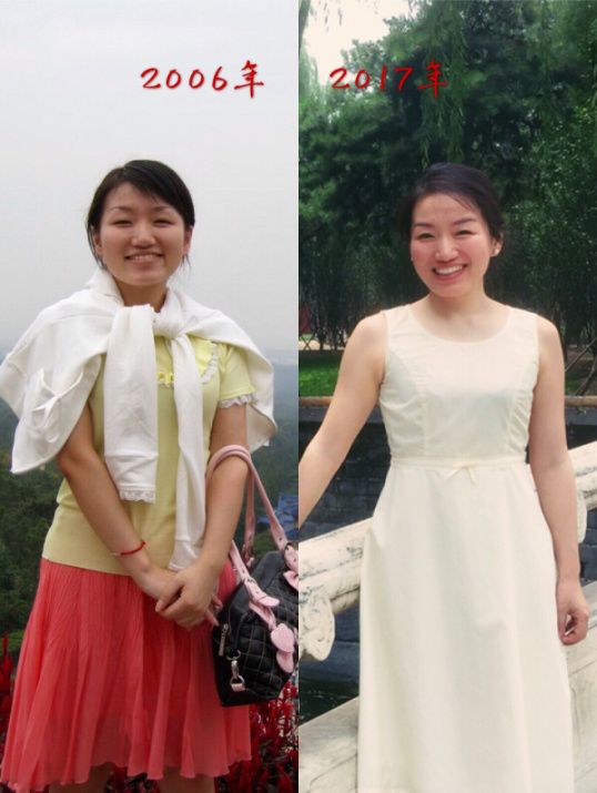 童颜机tripollar宙斯,童颜机tripollar溶脂