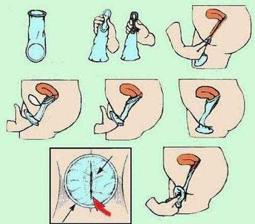 科普世界避孕日,世界避孕日活动注意事项