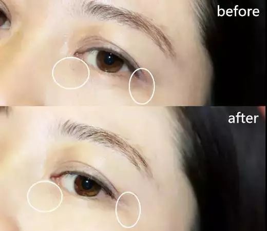 眼膜眼霜推荐排行榜第一名,眼膜眼霜推荐平价学生