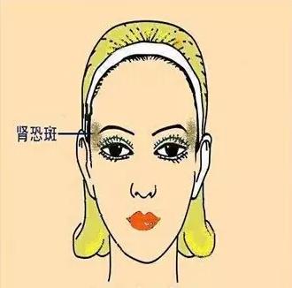 如何识别各种不同的斑,不同位置的色斑叫什么