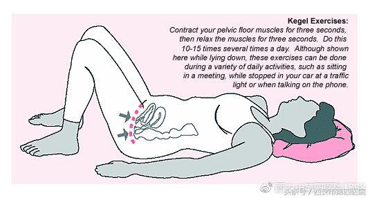 正确的盆底肌锻炼方法产后恢复,怎样锻炼盆底肌产后恢复