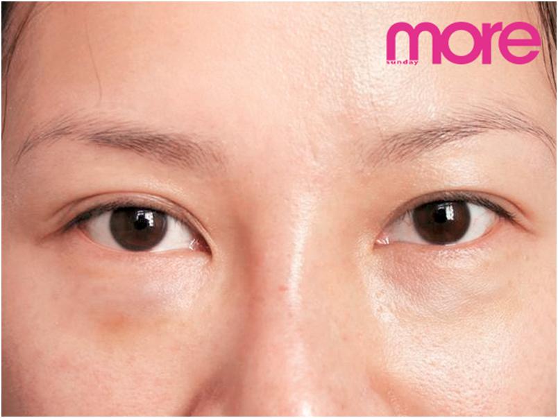 9大秘籍轻松搞定黑眼圈,有效快速解决黑眼圈的方法