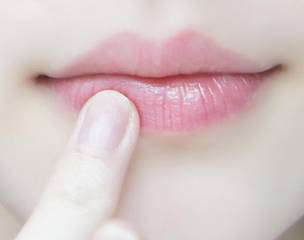 有唇纹怎么去除唇纹,修复唇纹淡化唇纹