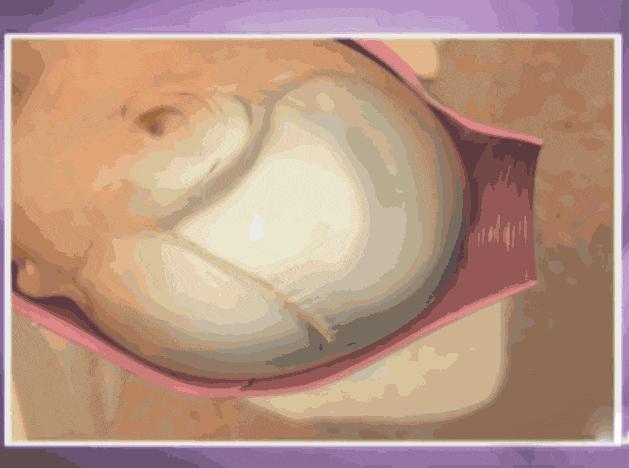 顺产需要开几指才可以用力,顺产开十指要侧切吗