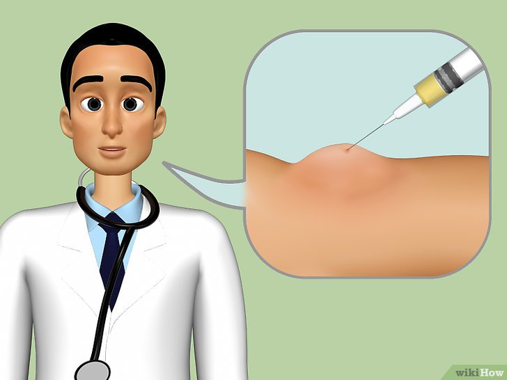 囊肿就是瘤吗,囊肿就是结节吗