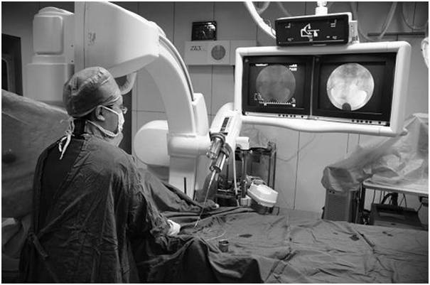 输卵管臭氧介入治疗和造影剂,介入治疗输卵管堵塞需要打麻药嘛