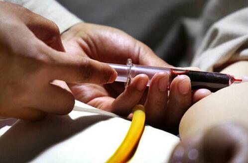 无创dna羊水穿刺会导致流产吗,羊水穿刺的风险和危害