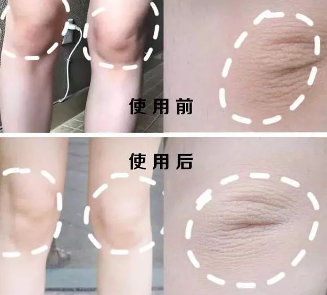 28天白一度美白套装,泰国米皂美白