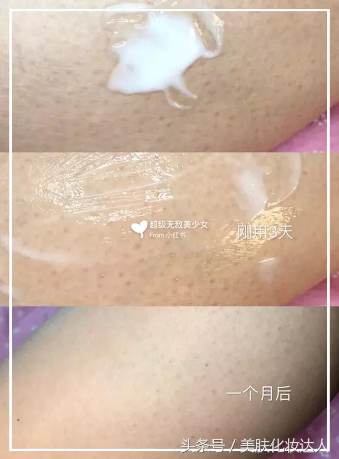 竟然连大幂幂都有解决不了的肌肤问题？