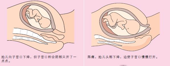 动画分娩过程科普,孕妈分娩的整个过程