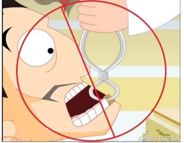 根管治疗后戴牙冠有什么不适感,根管治疗后戴牙冠有什么感觉吗