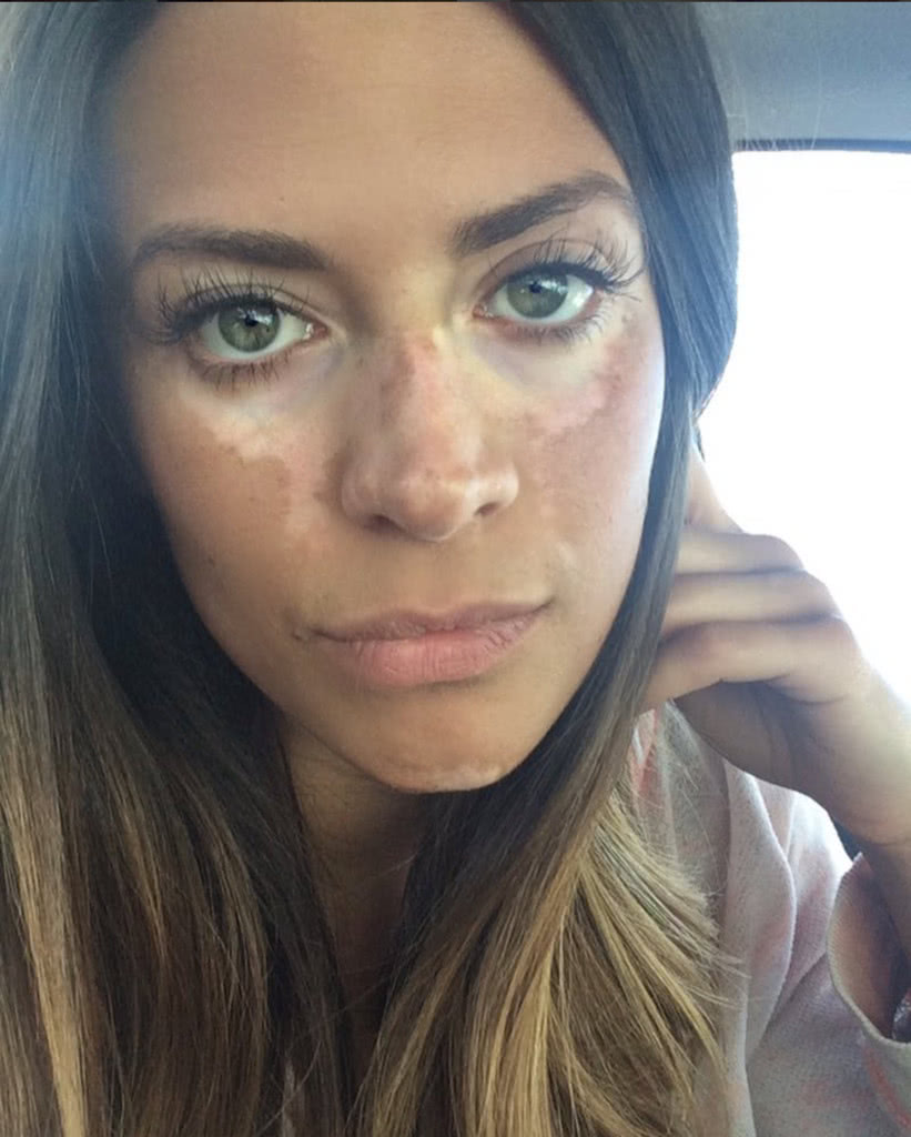 原来超模们也有苦恼和瑕疵——所以请接受生命的不完美吧