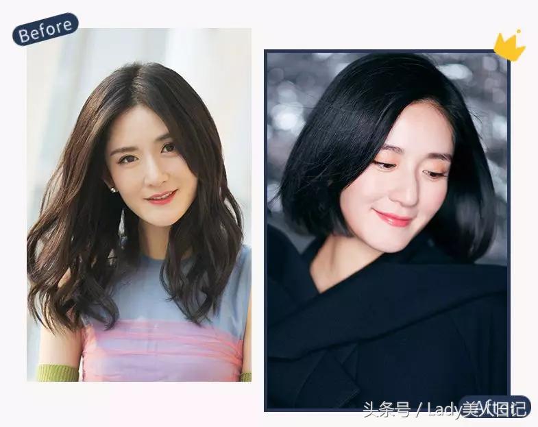 高级脸整容成功削骨,大脸削骨整容前后对比