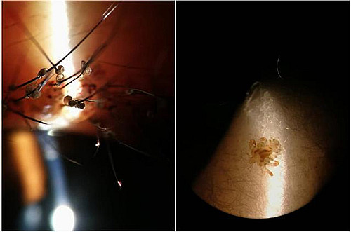 苏州儿童眼科检查,苏州儿童医院眼科医生