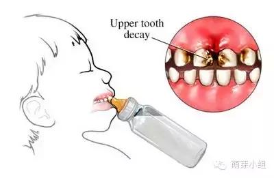 关注儿童牙齿健康不容忽视,对于儿童的牙齿是否重视