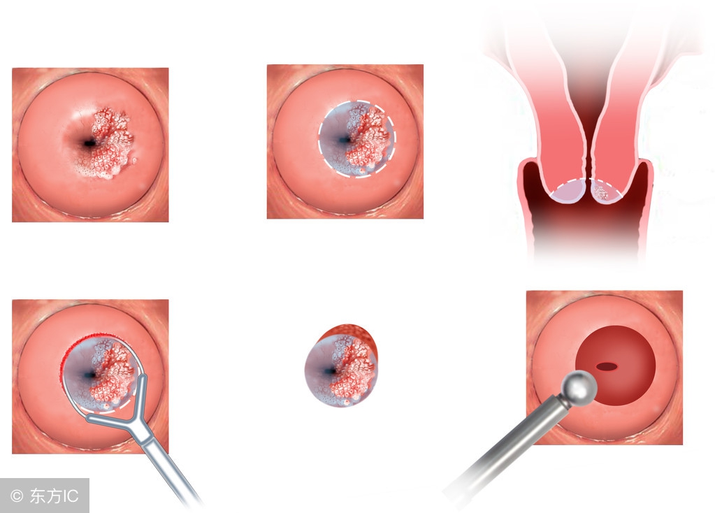 下腹经常隐隐作痛是怎么回事警惕是这种病作祟