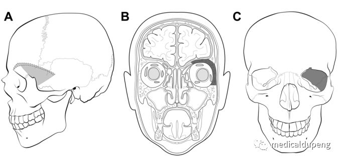 医学插画插图,医学插画sci