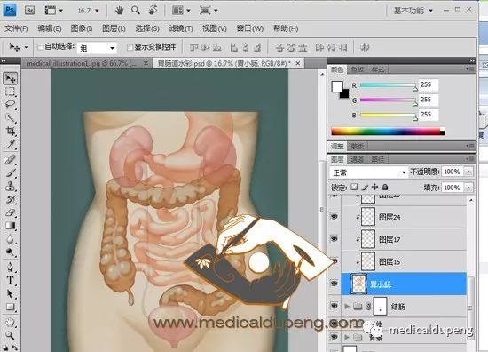 医学插画插图,医学插画sci