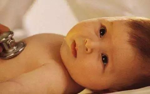 新生儿黄疸会有生命危险吗,新生儿黄疸会导致死亡吗