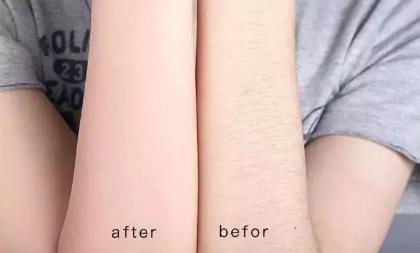 给毛裤脱毛,仙女脱毛最好的方法