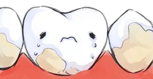 蛀牙三颗算多吗,蛀牙是怎么吃掉牙齿的