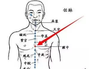 针灸治疼痛药方,针灸治疗各种痛症图解