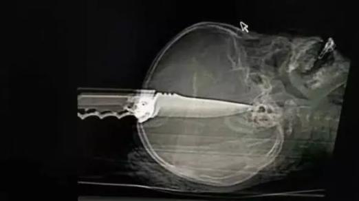 吸食毒粉会给人带来哪些影响,吸食毒物最大的危害