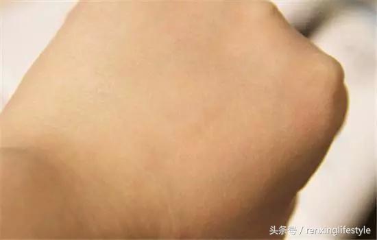 换季肌肤敏感起痘怎么办,秋冬换季干燥长痘怎么解决