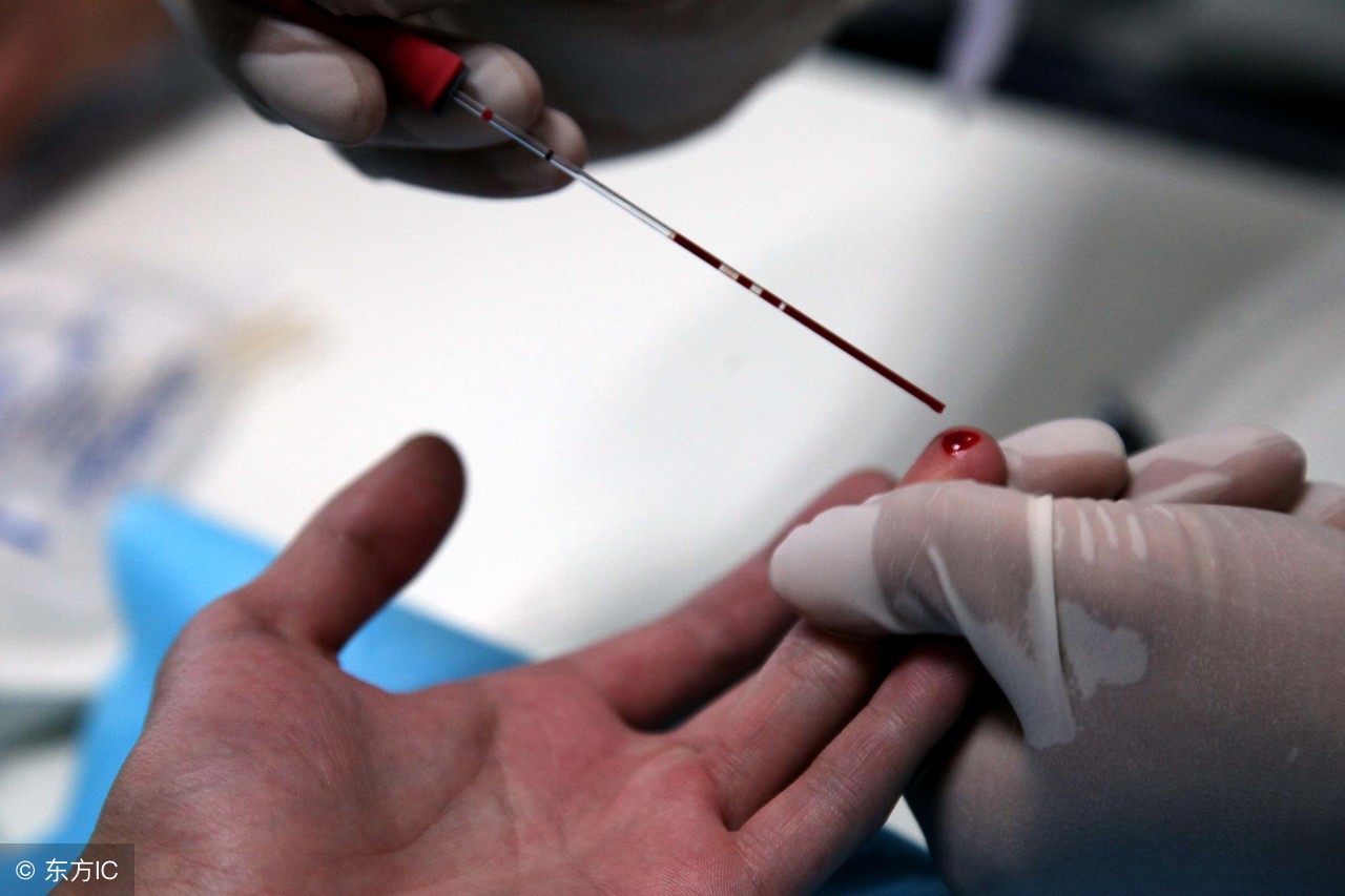 儿童感冒血常规化验单白细胞低,血常规化验单白细胞高低怎么看