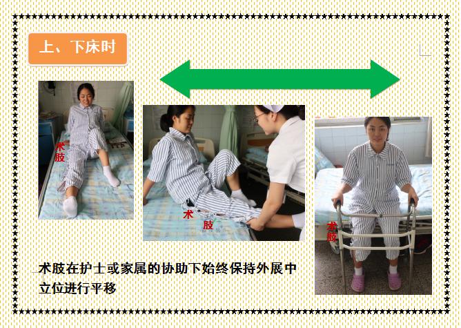 人工股骨头置换术术后教学查房,人工髋关节置换术后护理注意事项