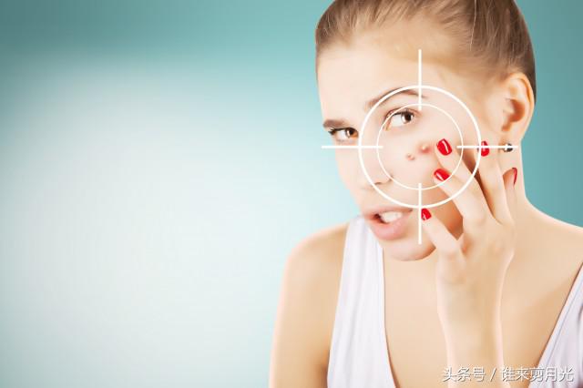 额头下巴反复长痘怎么中医调理,额头下巴长痘反复发作怎么治疗